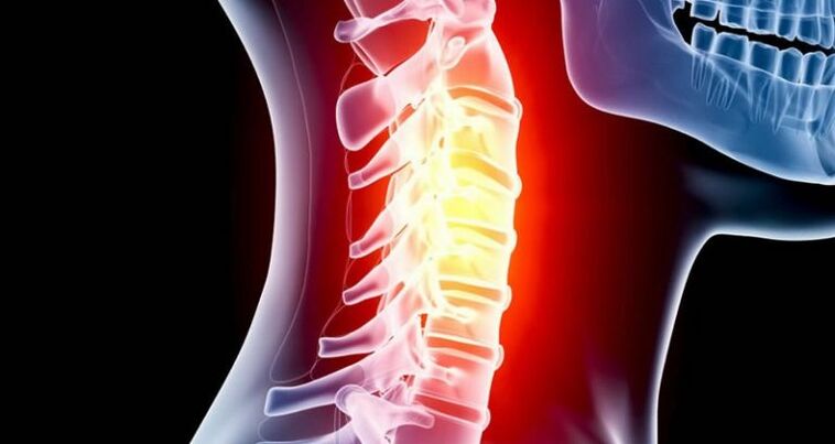 Panghubag sa rehiyon sa cervical