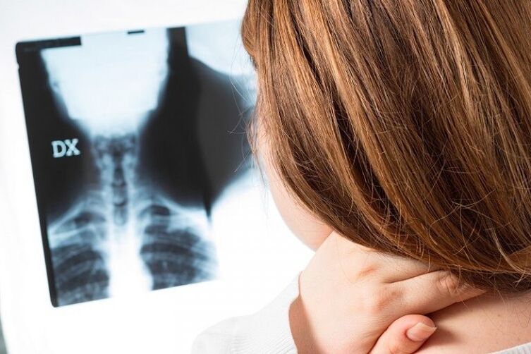 X -ray sa cervical nga rehiyon