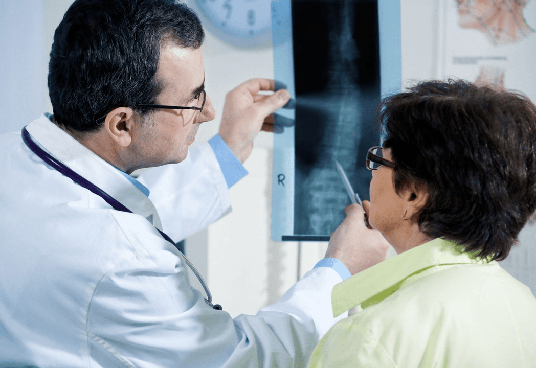 Ang usa ka neurologist nag-diagnose sa osteochondrosis gamit ang radiography sa dugokan