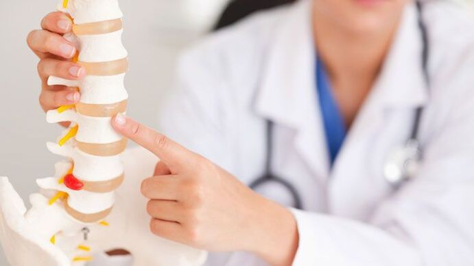 pagpatin-aw sa lumbar osteochondrosis sa usa ka modelo sa dugokan